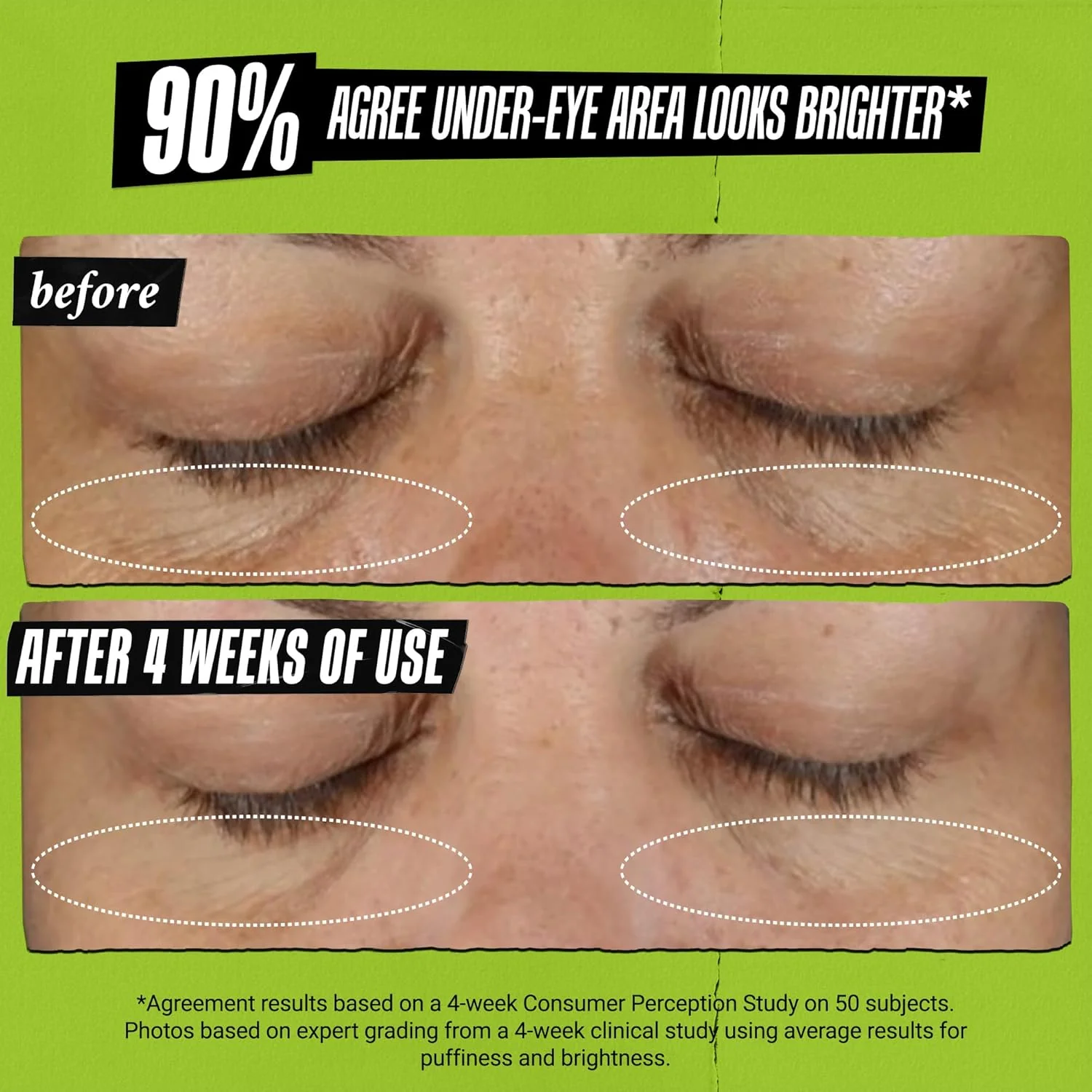 Creamy Eye Treatment With Avocado - Image 5