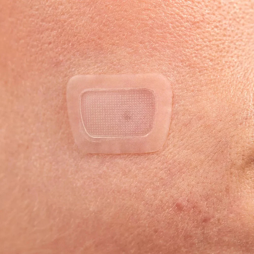 Miracle Microcrystal Acne Dark Spot Cover Pimple Patch - Image 5